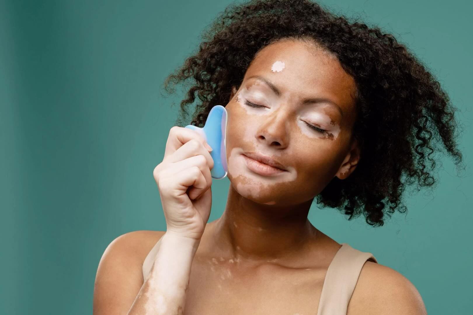 A Woman With Vitiligo Is Holding A Blue Object To Her Face — Chez Belle Skin Care & Beauty Centre in Pimlico, QLD
