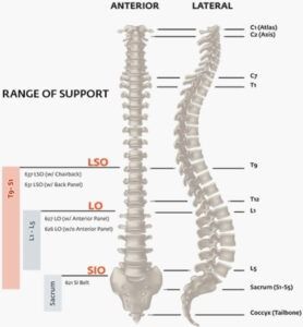 Spine diagram showing anterior and lateral views with range of support for LSO, LSO, and SIO braces.