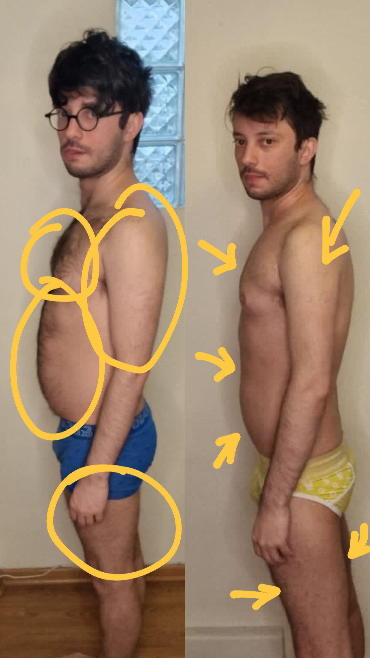 Two pictures of a woman before and after losing weight