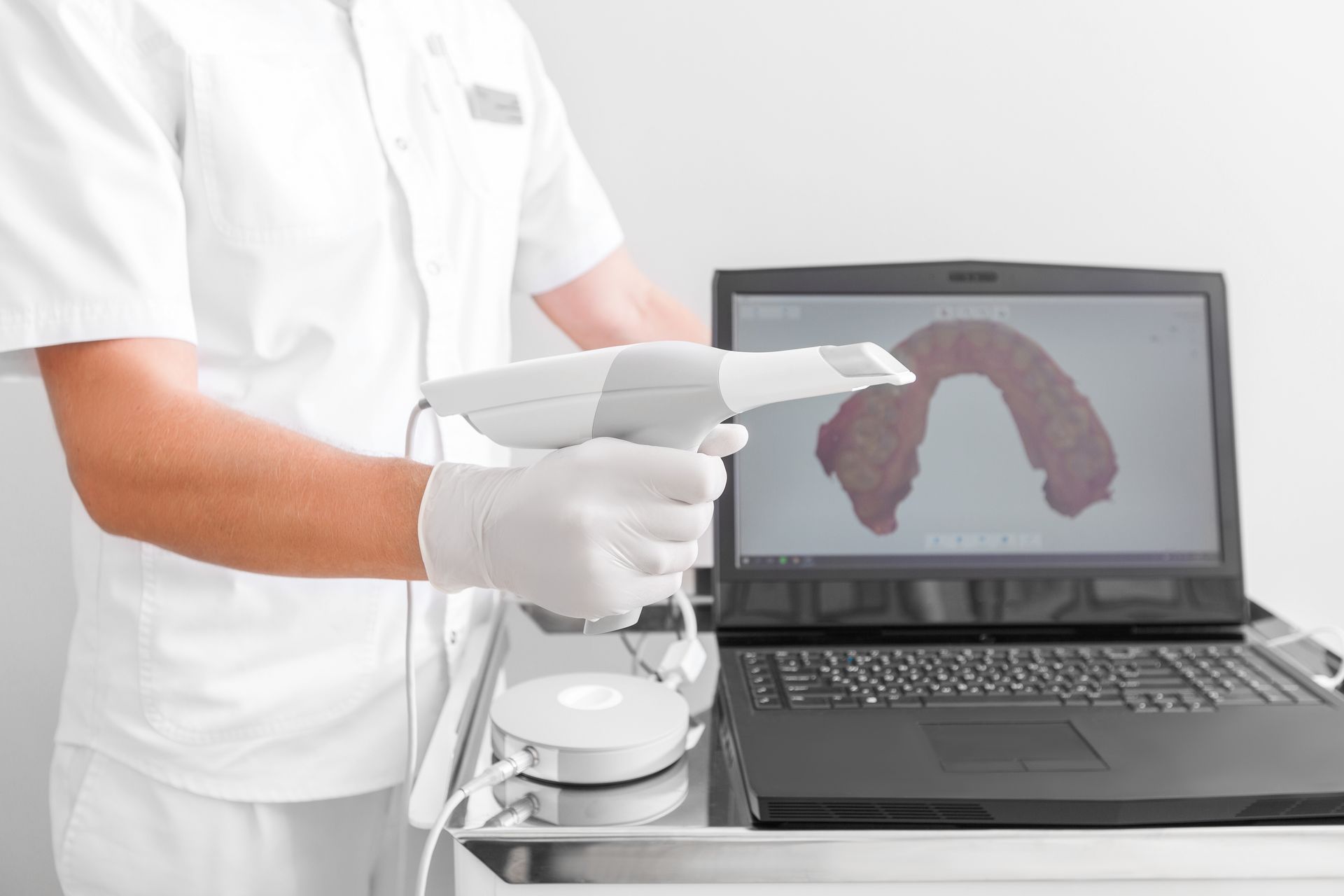 A dental professional wearing gloves holds an intraoral scanner next to a laptop displaying a 3D scan of a dental arch.