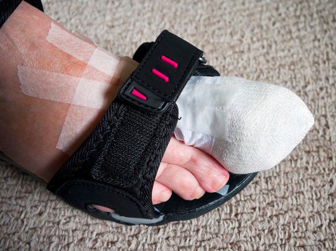 Diabetic Feet | Norwest, NSW | Amy McElveney Podiatry