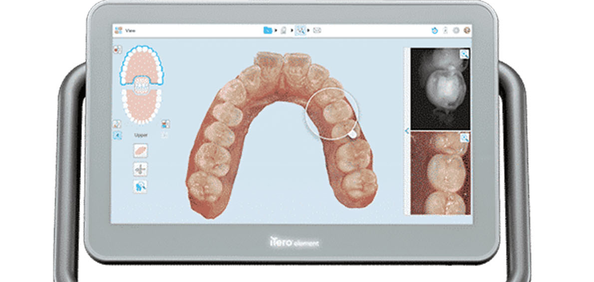 Escaneamento dentário na tela de um tablet, mostrando os dentes em cores e em radiografias. Itero.
