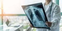 A doctor is holding an x-ray of a person 's lungs.