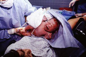 Medical Malpractice Attorney Greenville, NC