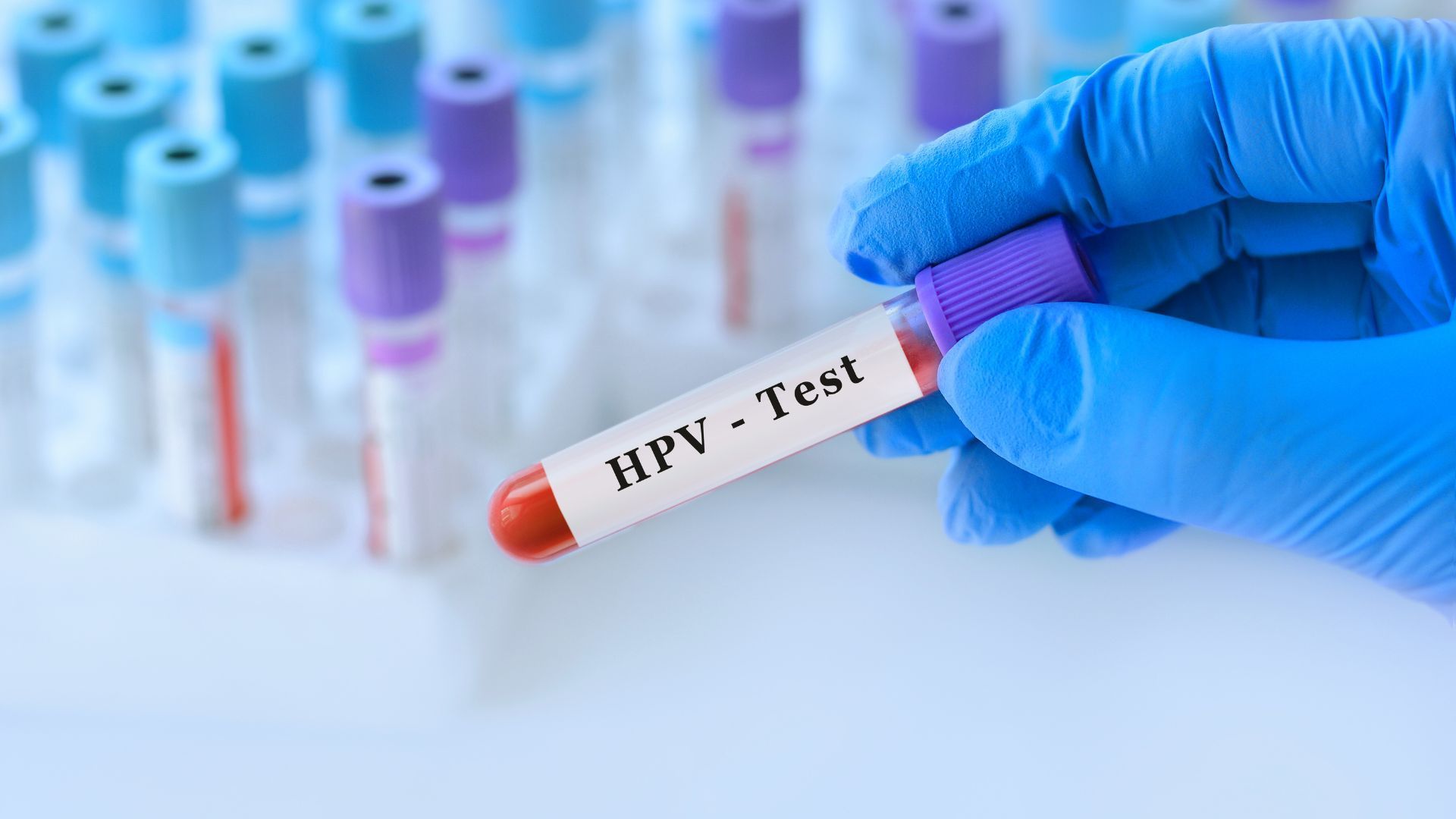 Una mano in un guanto blu tiene una provetta per un test hpv.