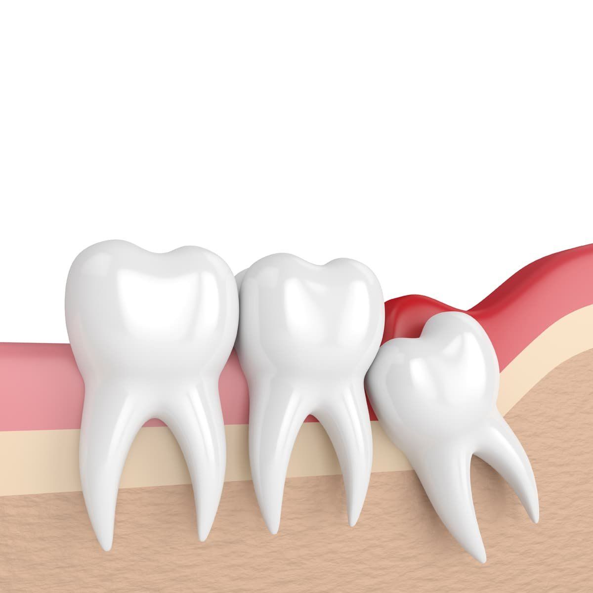 Broken Arrow, OK Dentist Oral Surgery Stonewood Hills OMS Broken Arrow, OK Dentist Oral Surgery Stonewood Hills OMS