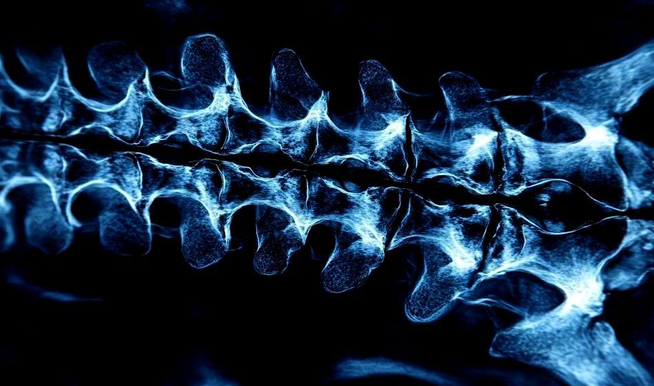 Radiografía azul de una columna vertebral, que muestra las vértebras y la columna vertebral sobre un fondo oscuro.