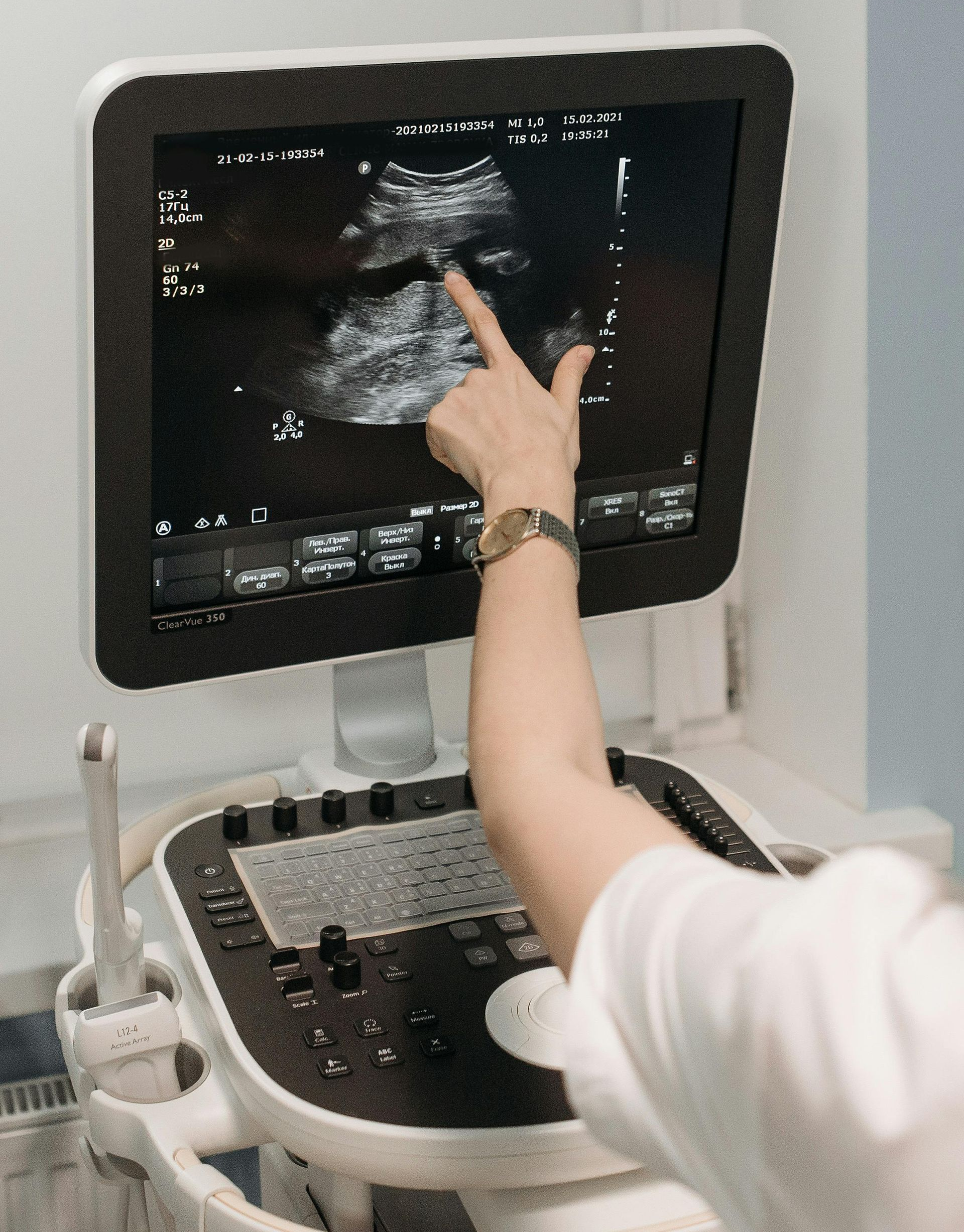 Person points at ultrasound image on a medical device screen.