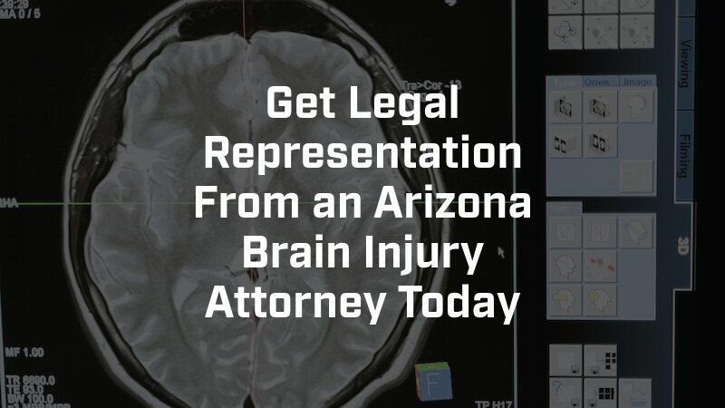 A picture of a brain with the words get legal representation from an arizona brain injury attorney today