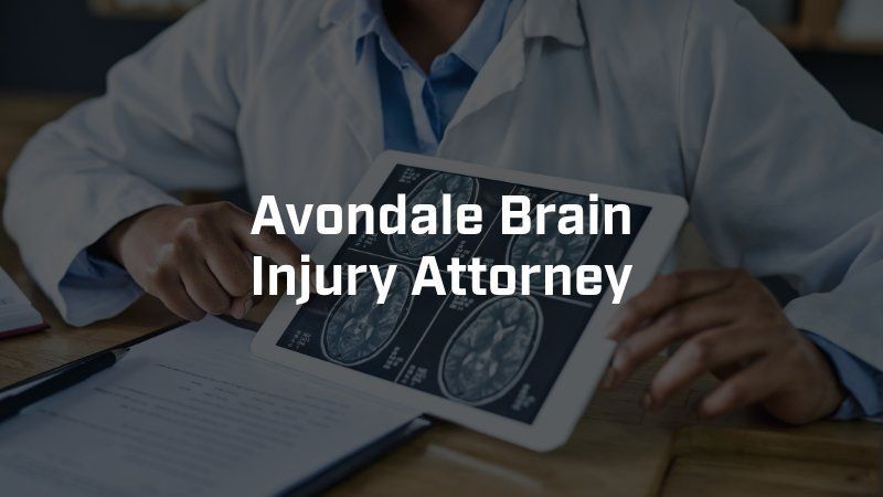 A doctor is holding a tablet with an x-ray of a brain on it.