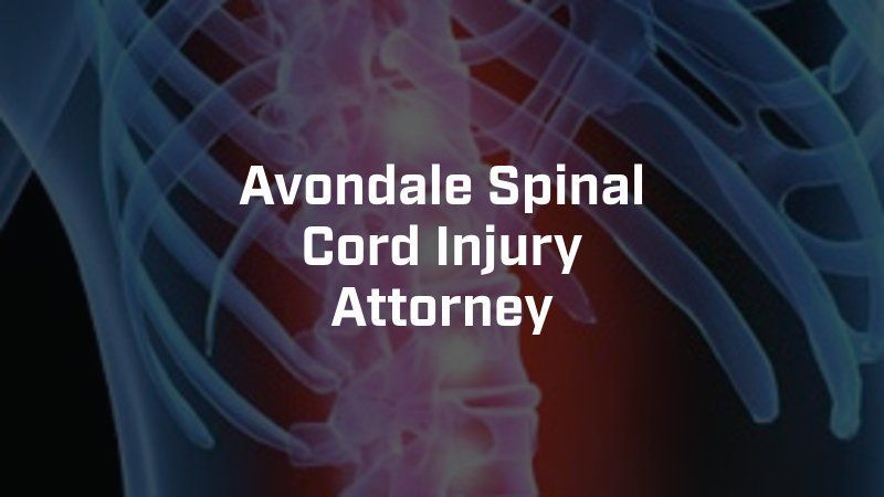A picture of a spinal cord injury attorney