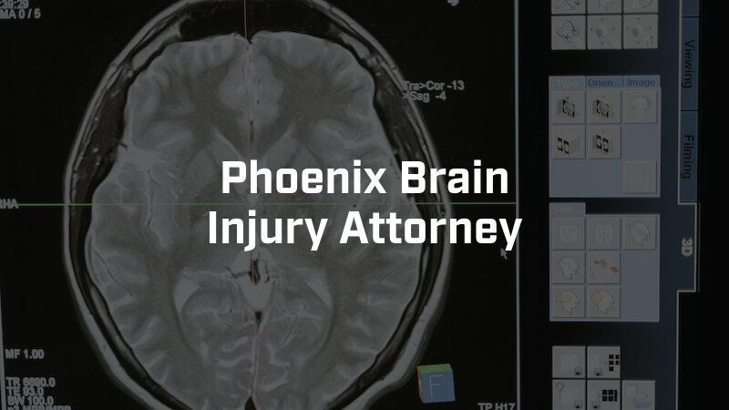 A picture of a brain with the words phoenix brain injury attorney