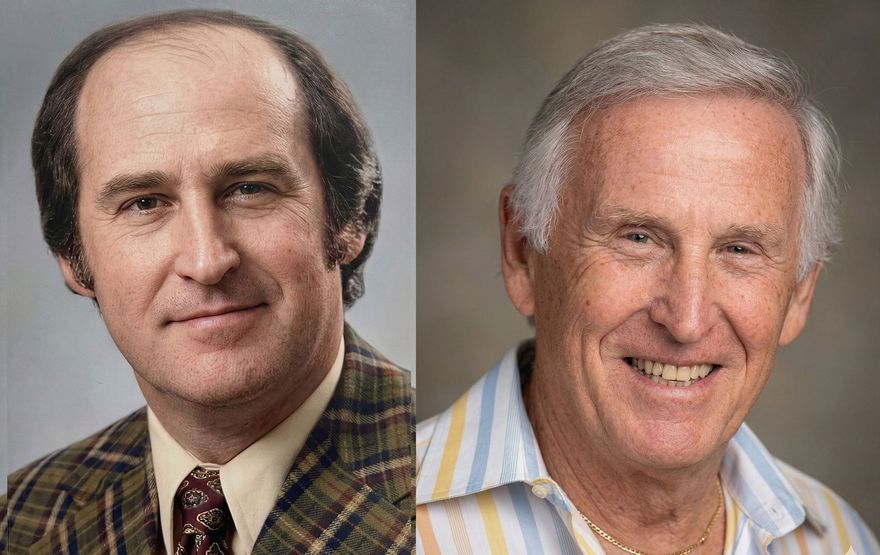 A side-by-side comparison of the same person with a shaved head on the left and with a full head of hair on the right.