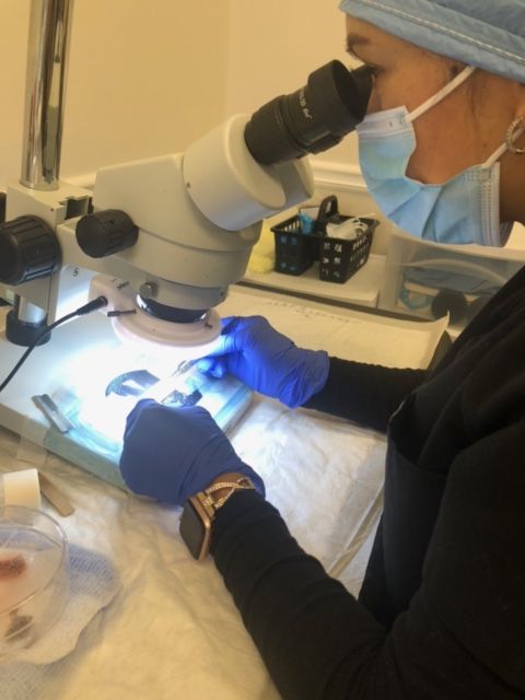 Medical professionals in gloves perform a hair transplant procedure on a patient’s scalp.
