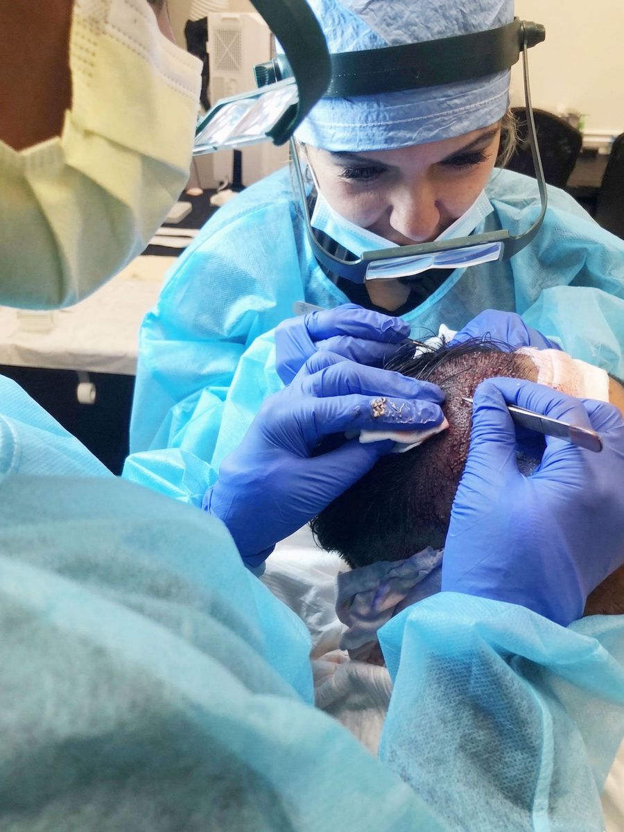 A close-up of a person's scalp being marked with a surgical pen to plan for 3,000 hair transplant grafts.