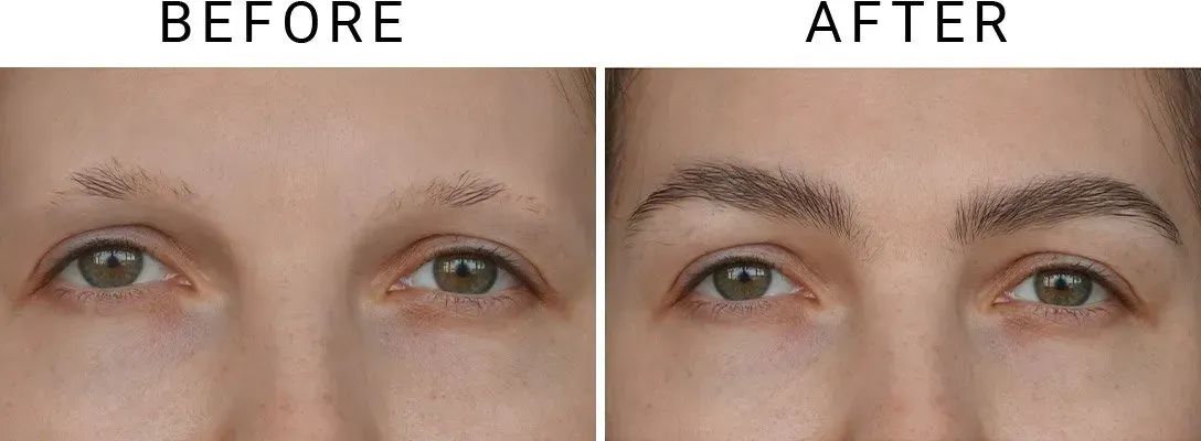 Before and after comparison of eyebrow enhancement. Sparse eyebrows before, filled-in, defined eyebrows after.