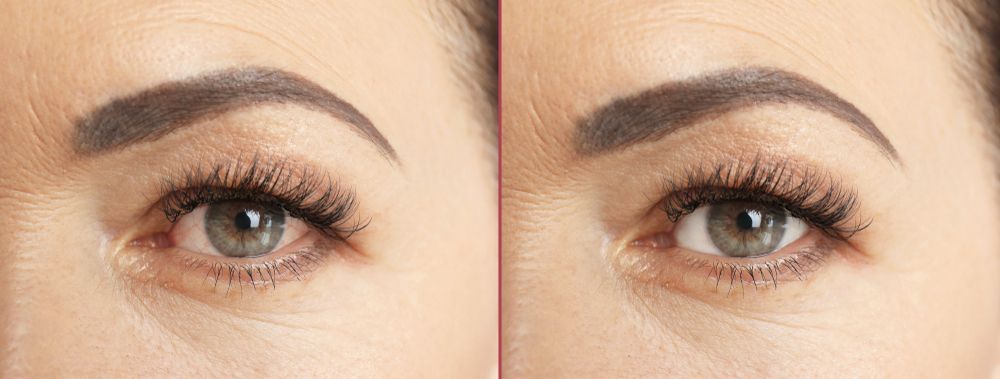 Close-up of two eyes, showing eyebrows, eyelashes, and wrinkles around the eyes.