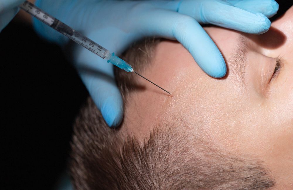 A person receiving an injection in their forehead. Gloved hand holds syringe near skin.