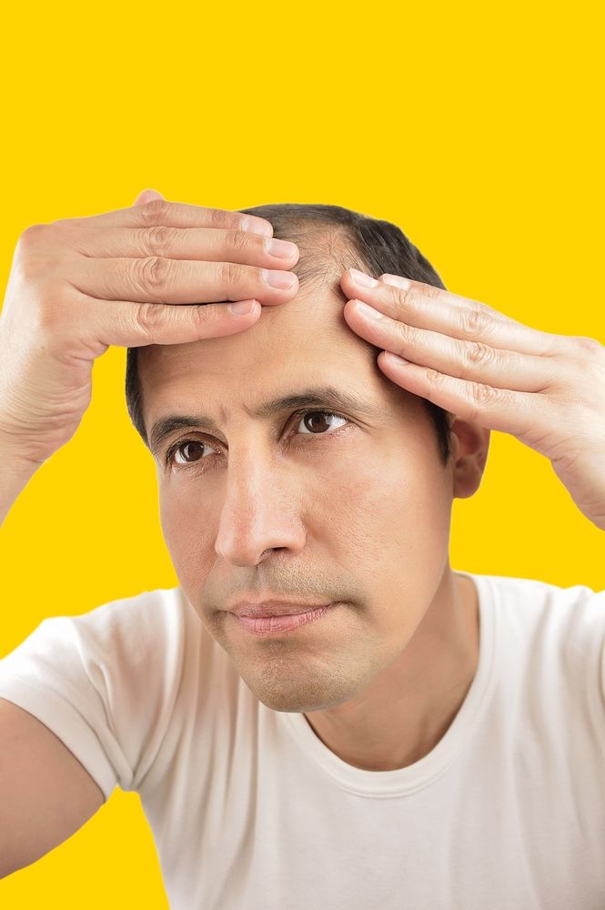Man examining his receding hairline with both hands, yellow background.