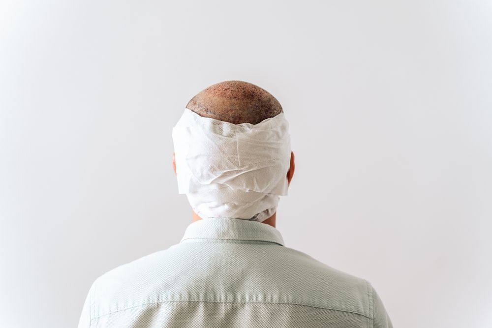 A person from the back with surgical dressing on the scalp and head, light blue shirt.