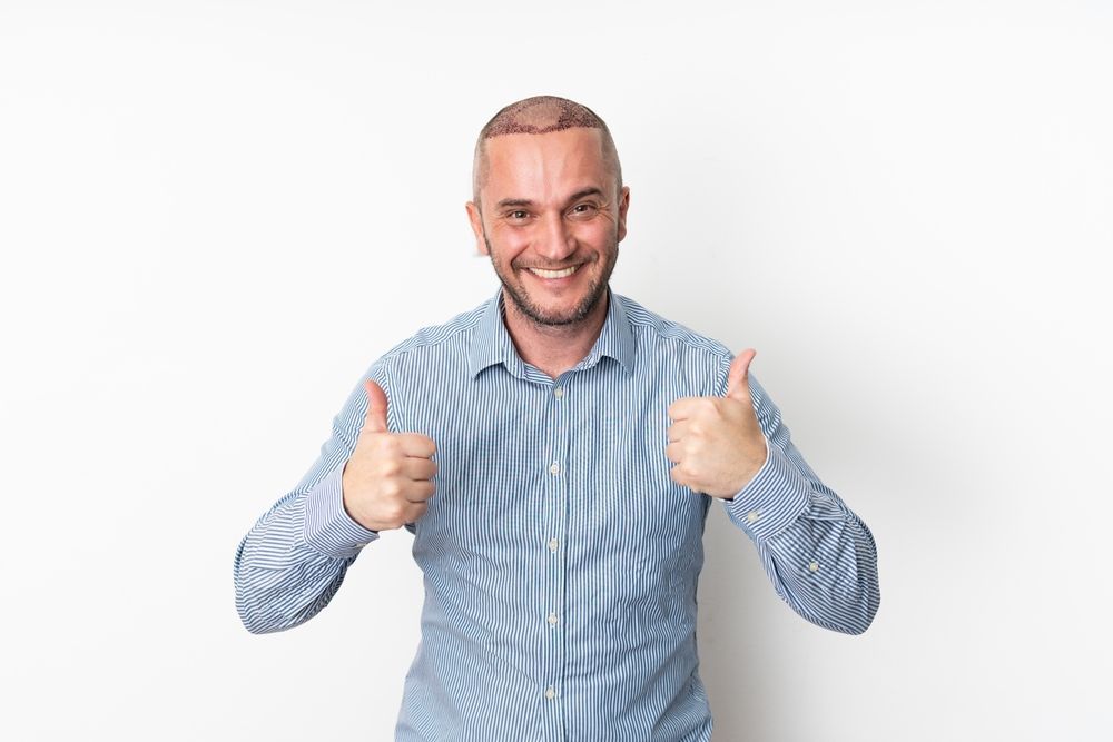 Man with a shaved head smiles with thumbs up, wearing a blue-striped button-down shirt.