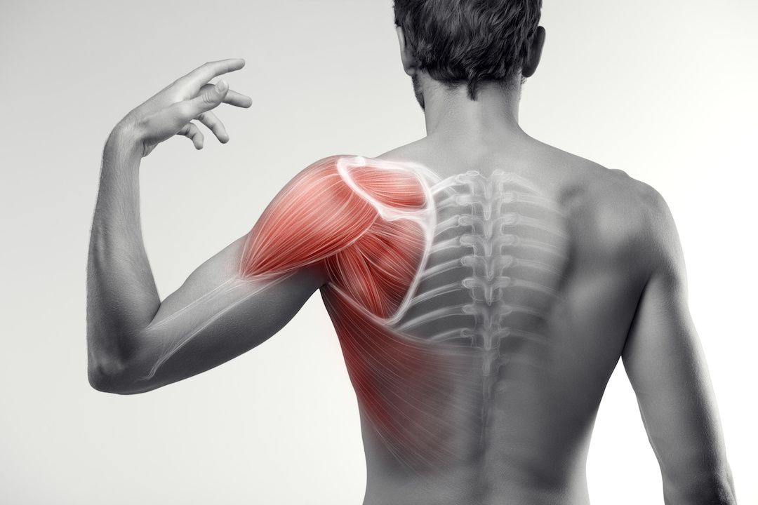 Sports Injury Shoulder Pain Treatment
