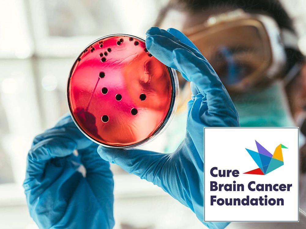A person is holding a petri dish with a logo for the cure brain cancer foundation