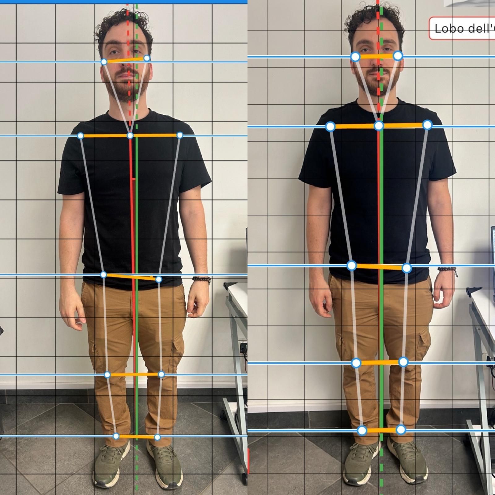 Gnatologia - postura a Balduina - Roma