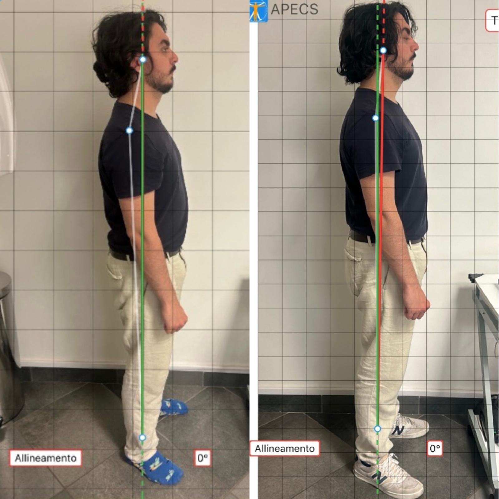 Gnatologia - postura a Balduina - Roma