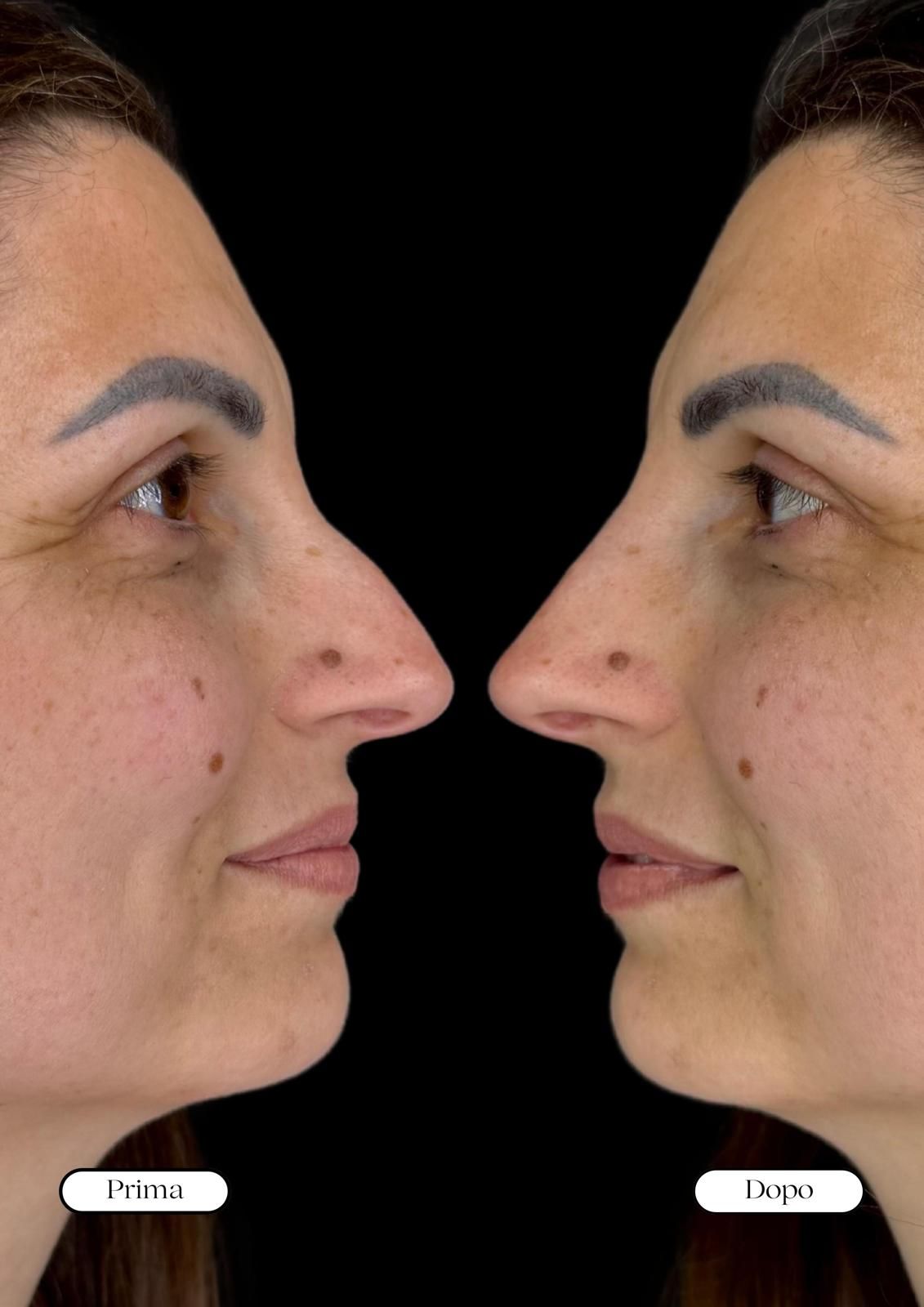 Medicina estetica a Balduina - Roma - Studio Stefania Lanzuolo