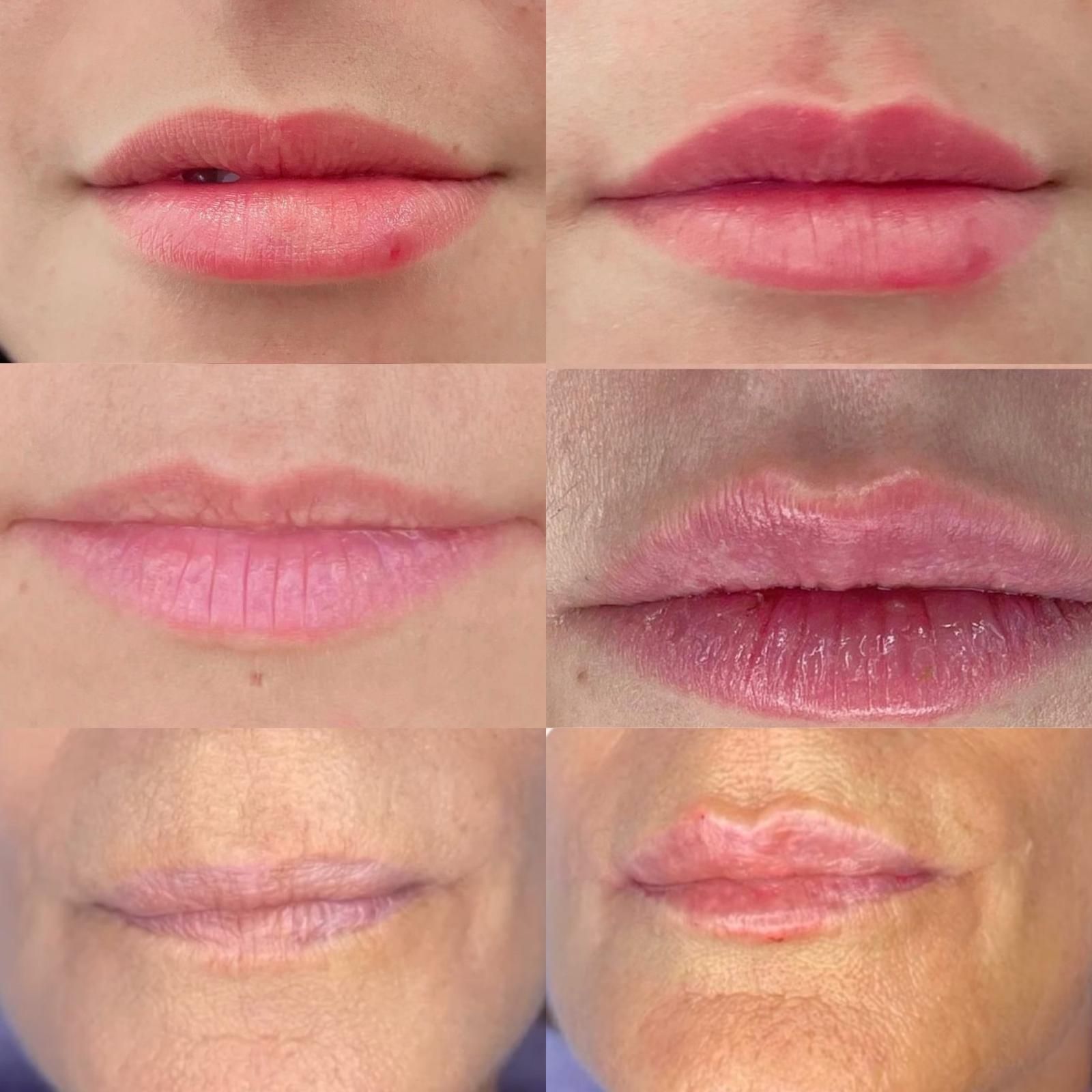 Medicina estetica a Balduina - Roma - Studio Stefania Lanzuolo