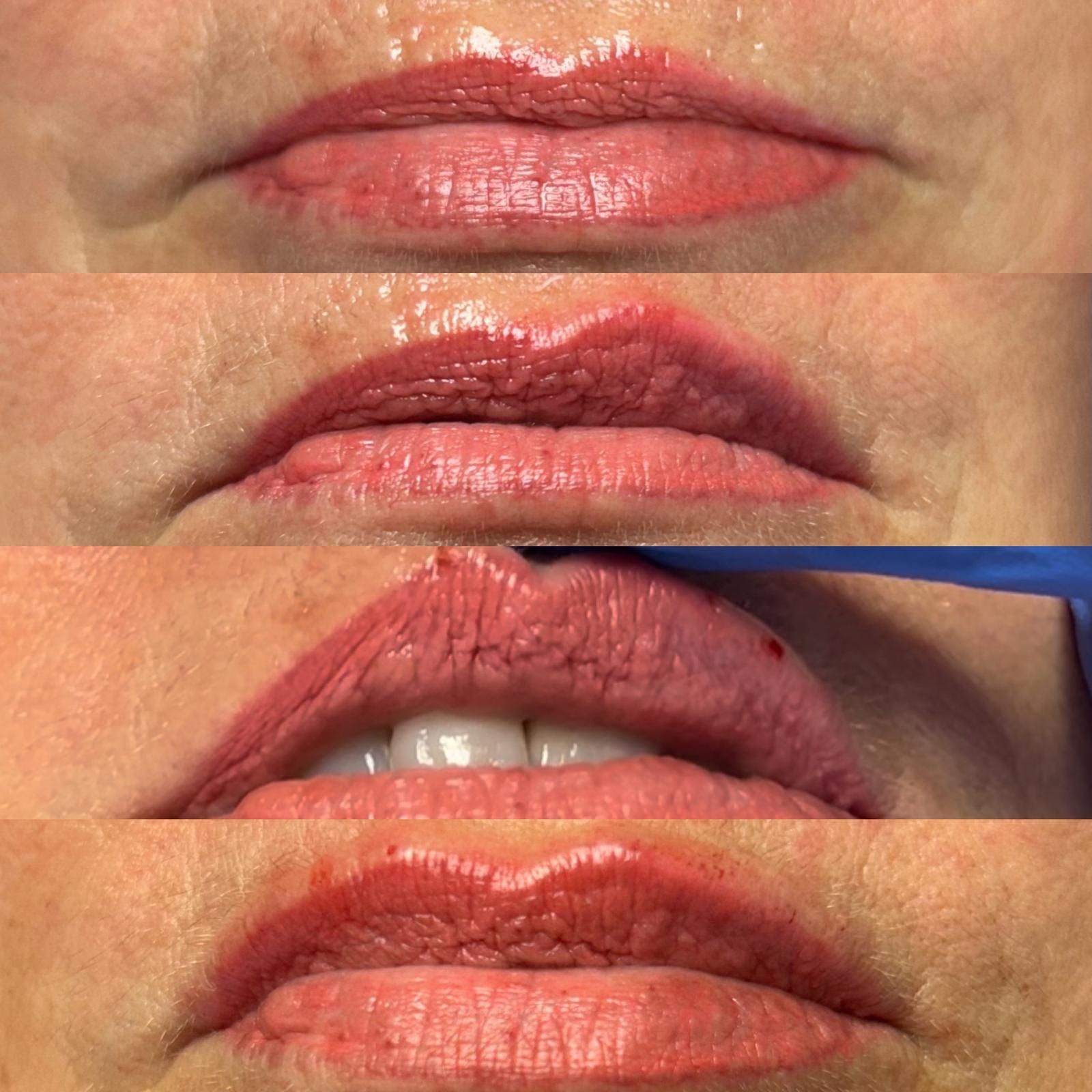 Medicina estetica a Balduina - Roma - Studio Stefania Lanzuolo