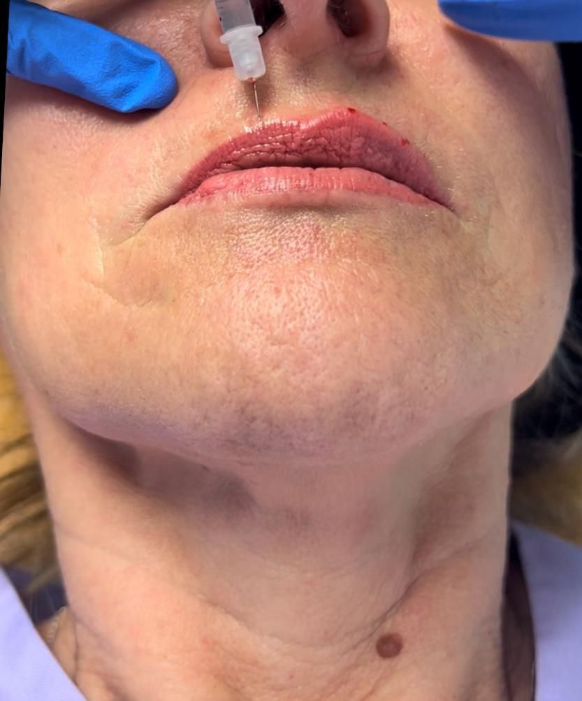 medicina estetica Studio Lanzuolo a Balduina Roma