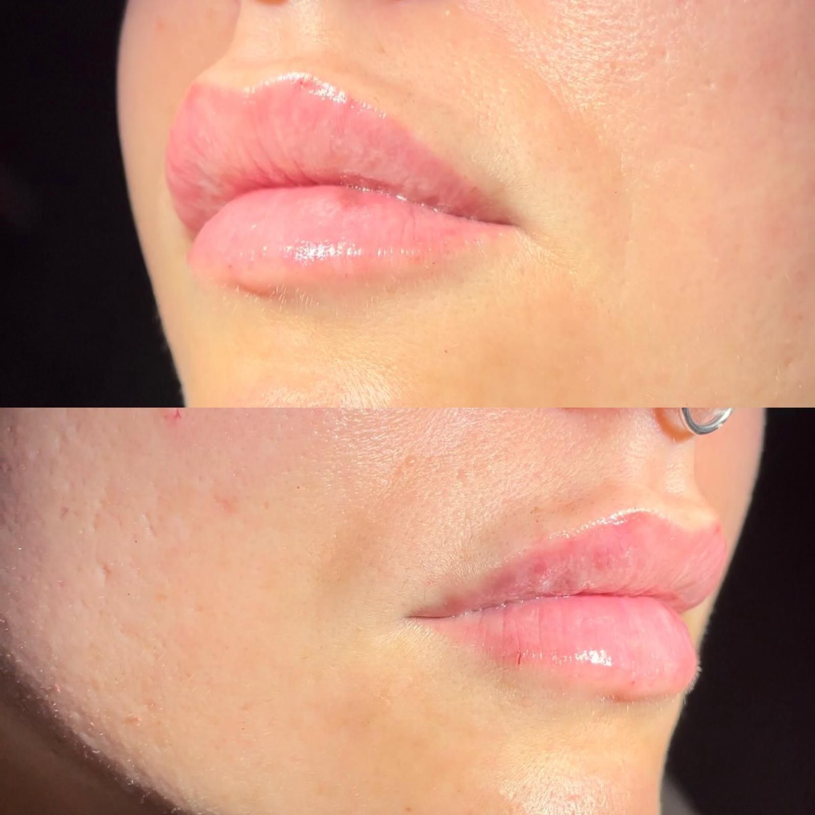 Medicina estetica a Balduina - Roma - Studio Stefania Lanzuolo