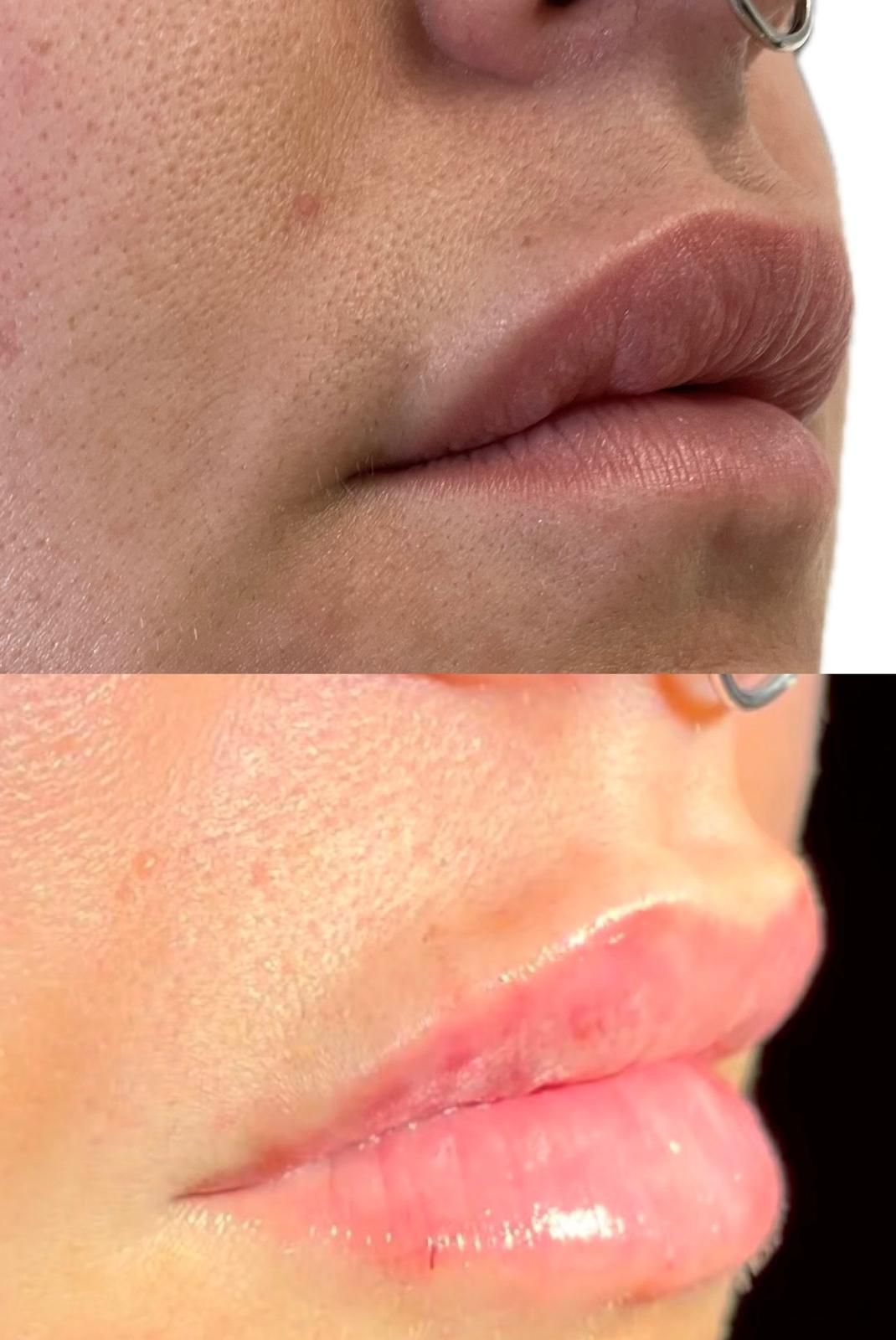 Medicina estetica a Balduina - Roma - Studio Stefania Lanzuolo