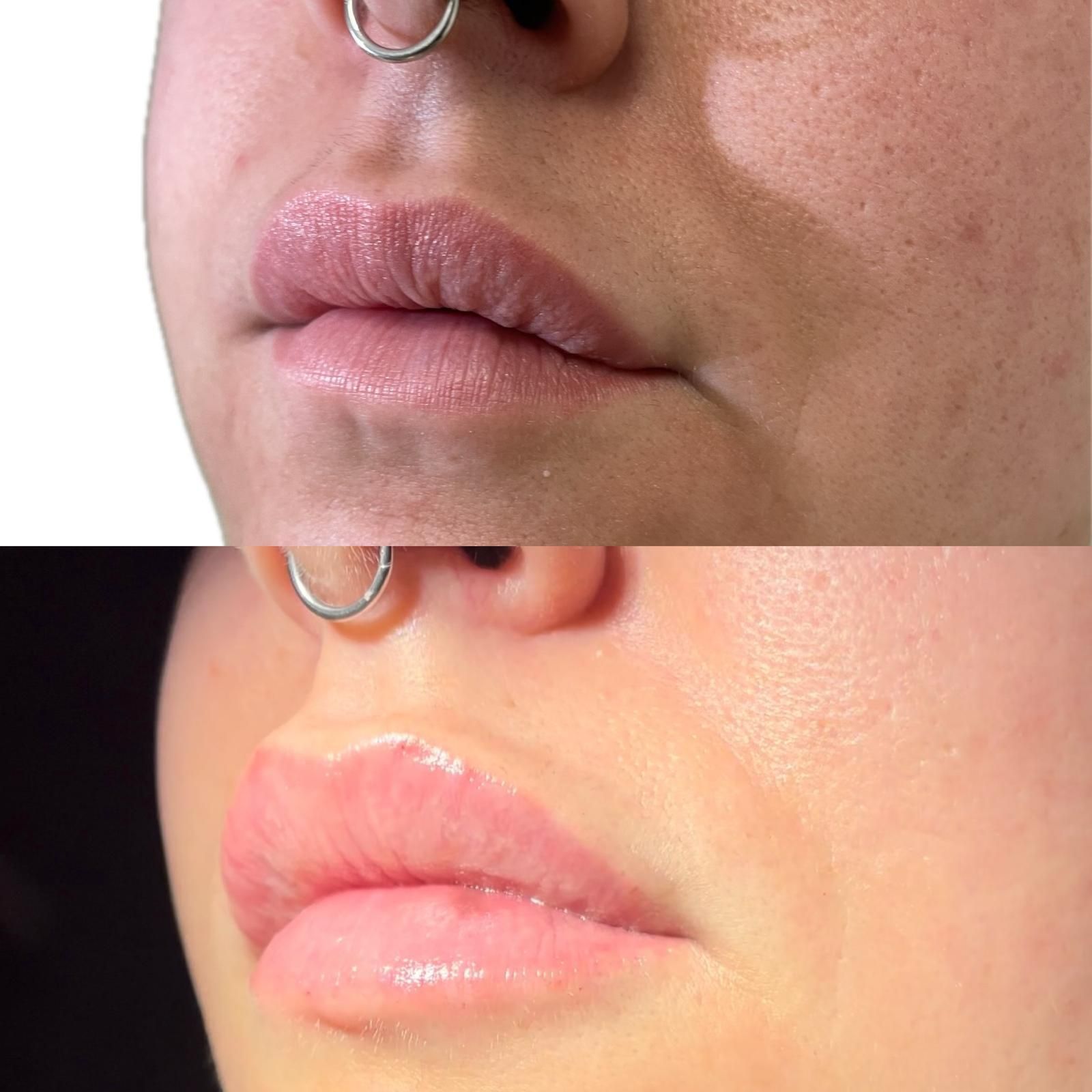 Medicina estetica a Balduina - Roma - Studio Stefania Lanzuolo