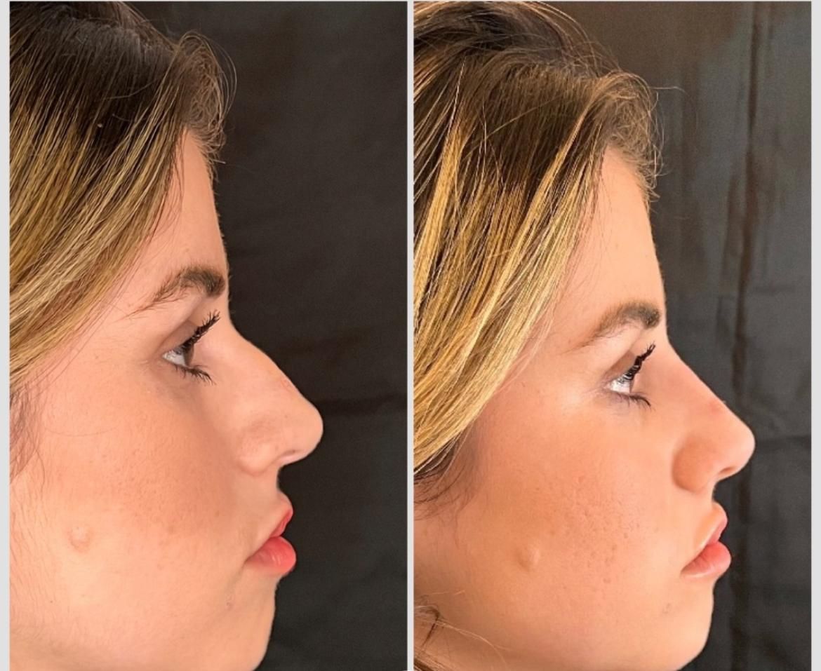 Medicina estetica a Balduina - Roma - Studio Stefania Lanzuolo