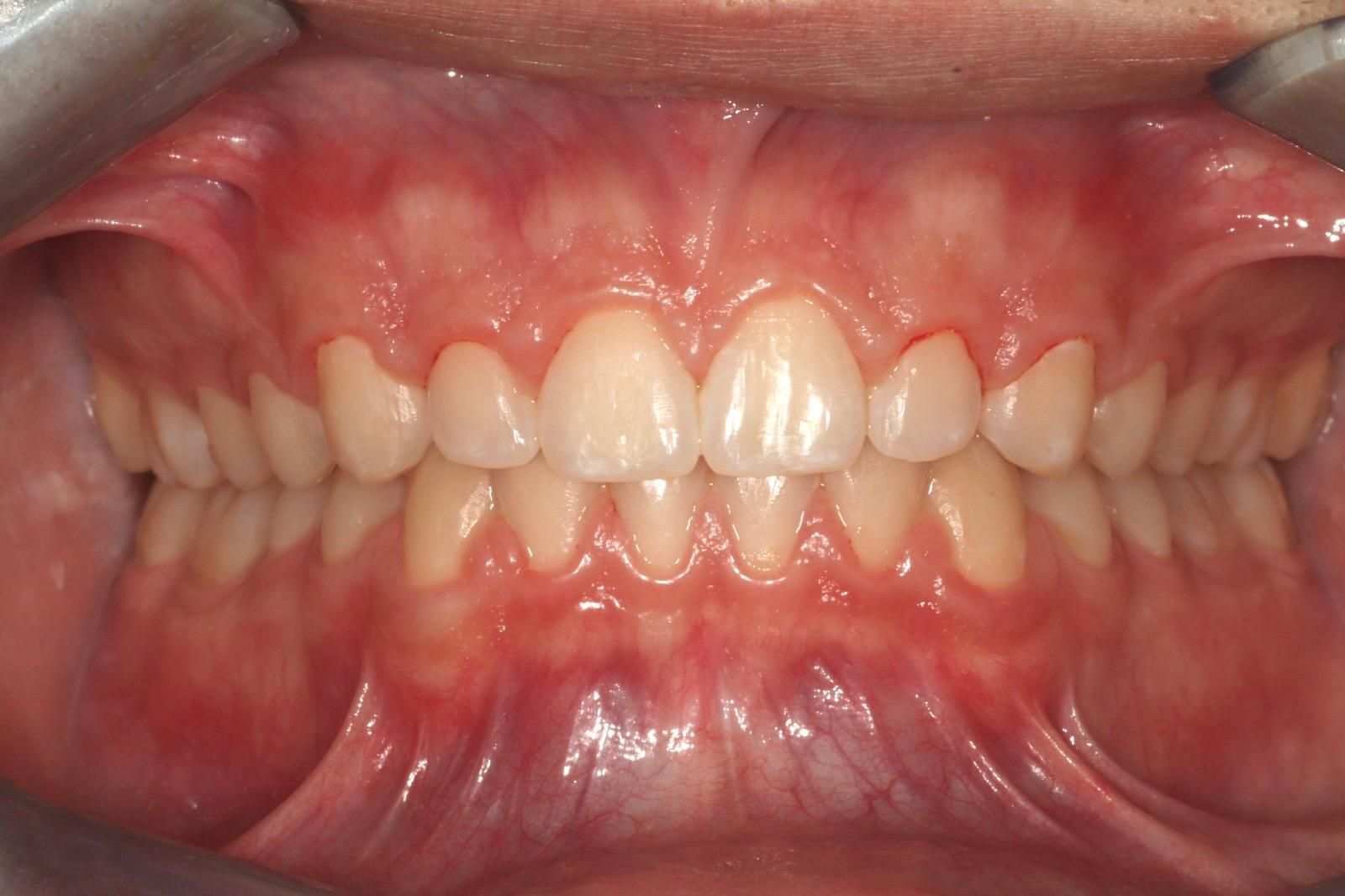 ortodonzia Studio Lanzuolo a Balduina Roma