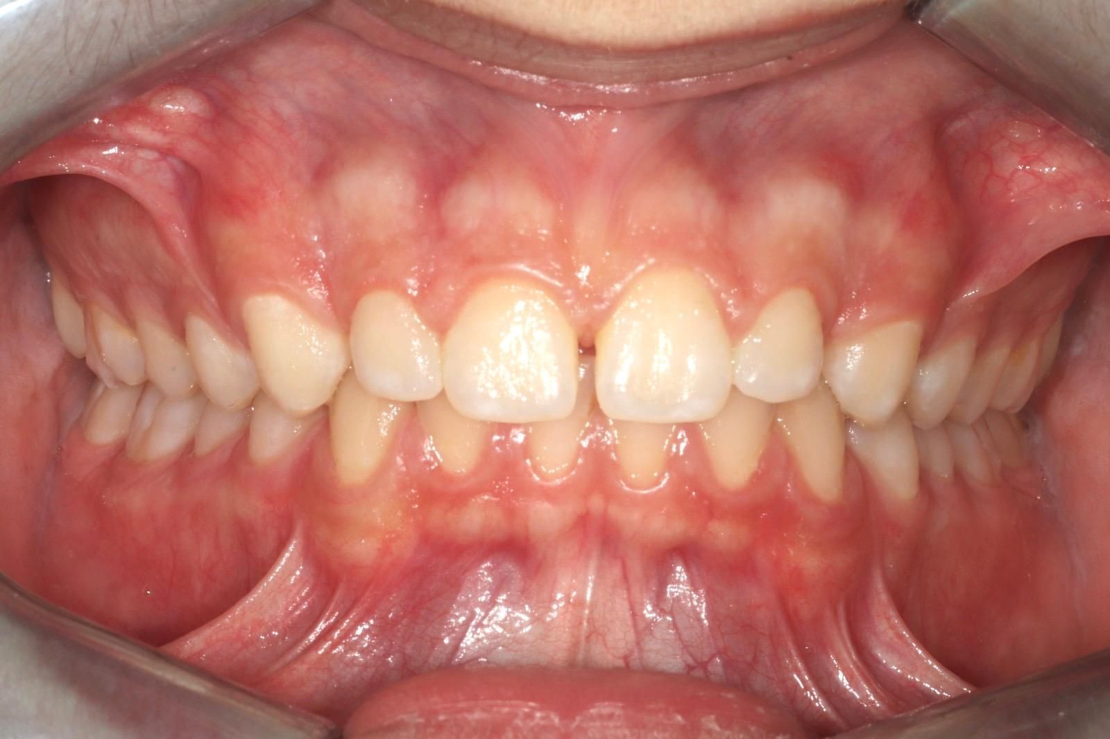 ortodonzia Studio Lanzuolo a Balduina Roma