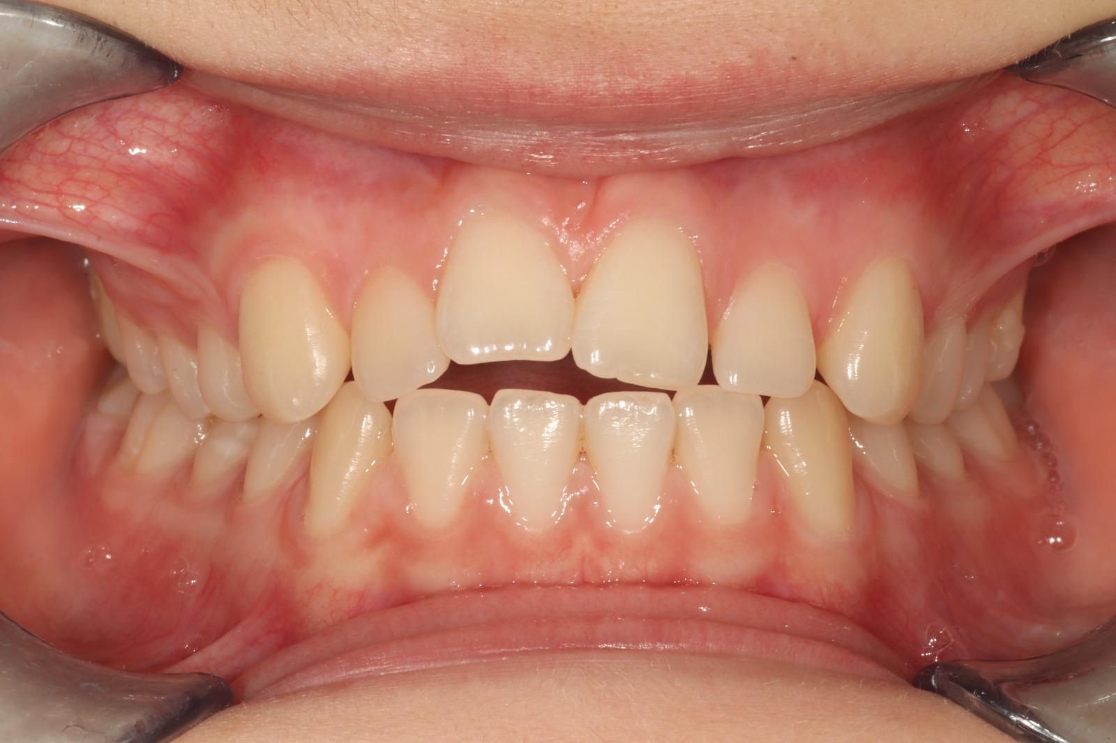 ortodonzia Studio Lanzuolo a Balduina Roma