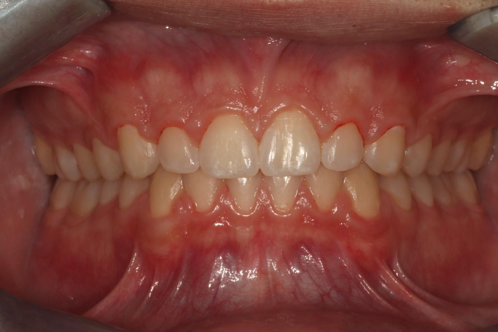 ortodonzia Studio Lanzuolo a Balduina Roma