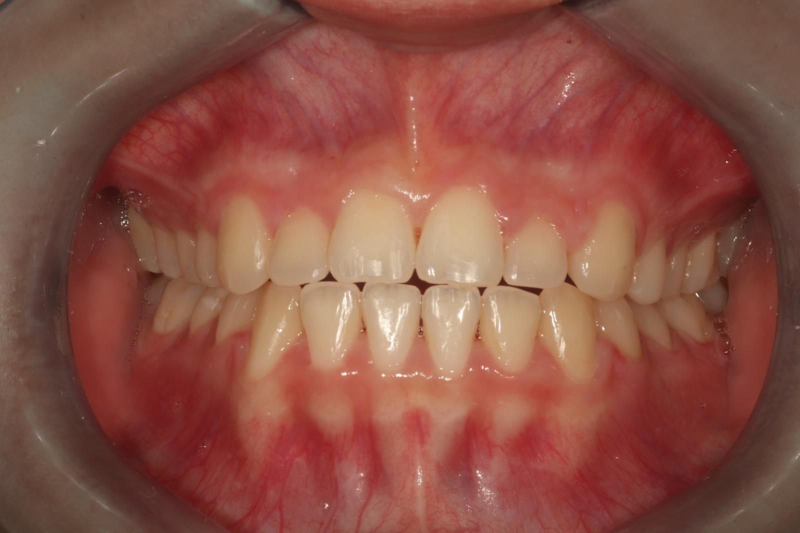 ortodonzia Studio Lanzuolo a Balduina Roma