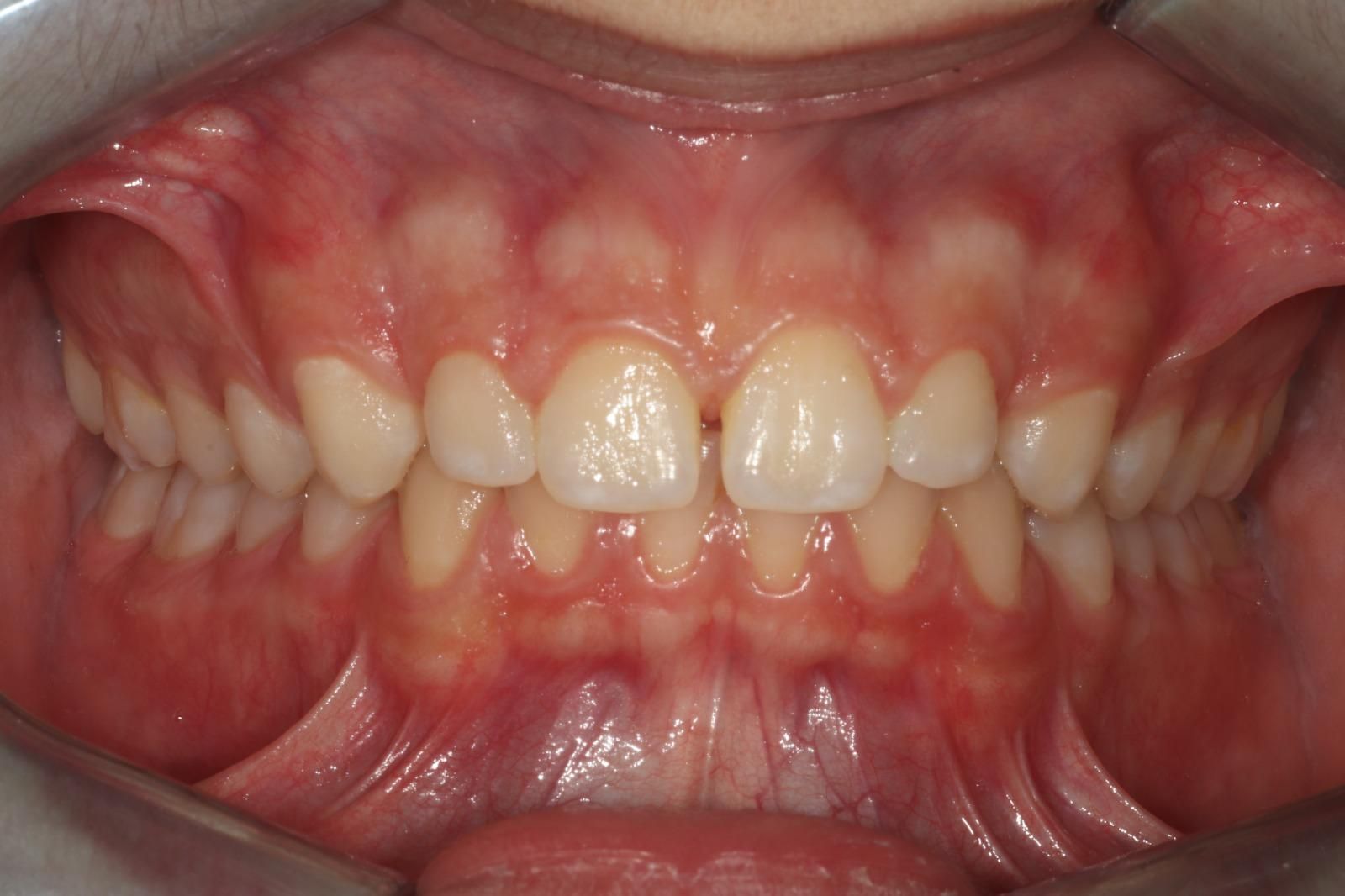 ortodonzia Studio Lanzuolo a Balduina Roma