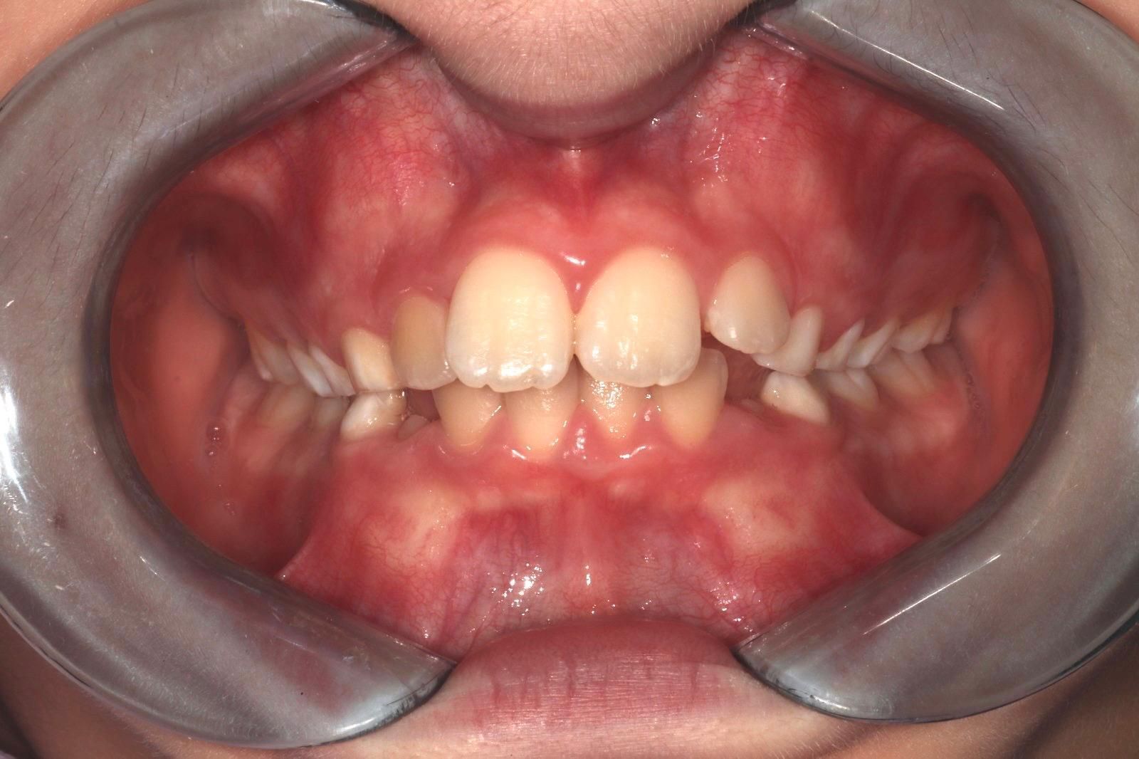 ortodonzia Studio Lanzuolo a Balduina Roma