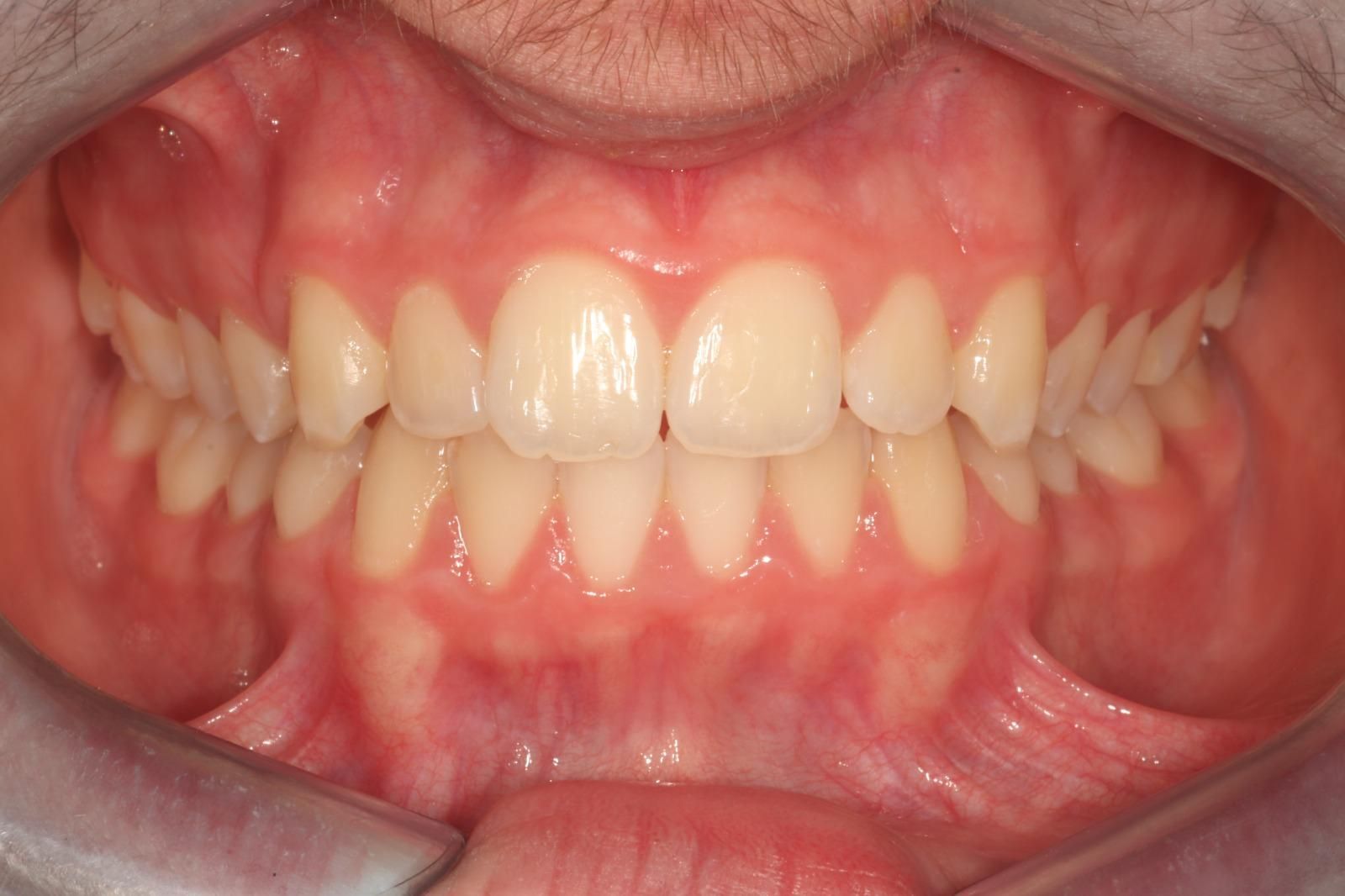 ortodonzia Studio Lanzuolo a Balduina Roma