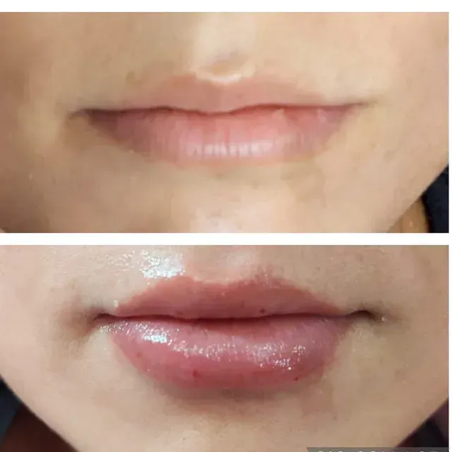 GELISH ROOM - Hyaluronic Pen