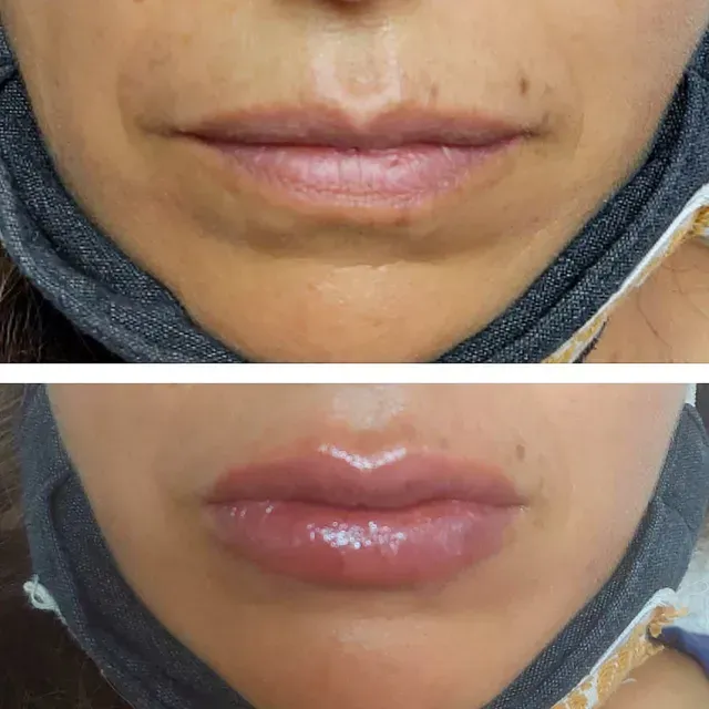 GELISH ROOM - Hyaluronic Pen