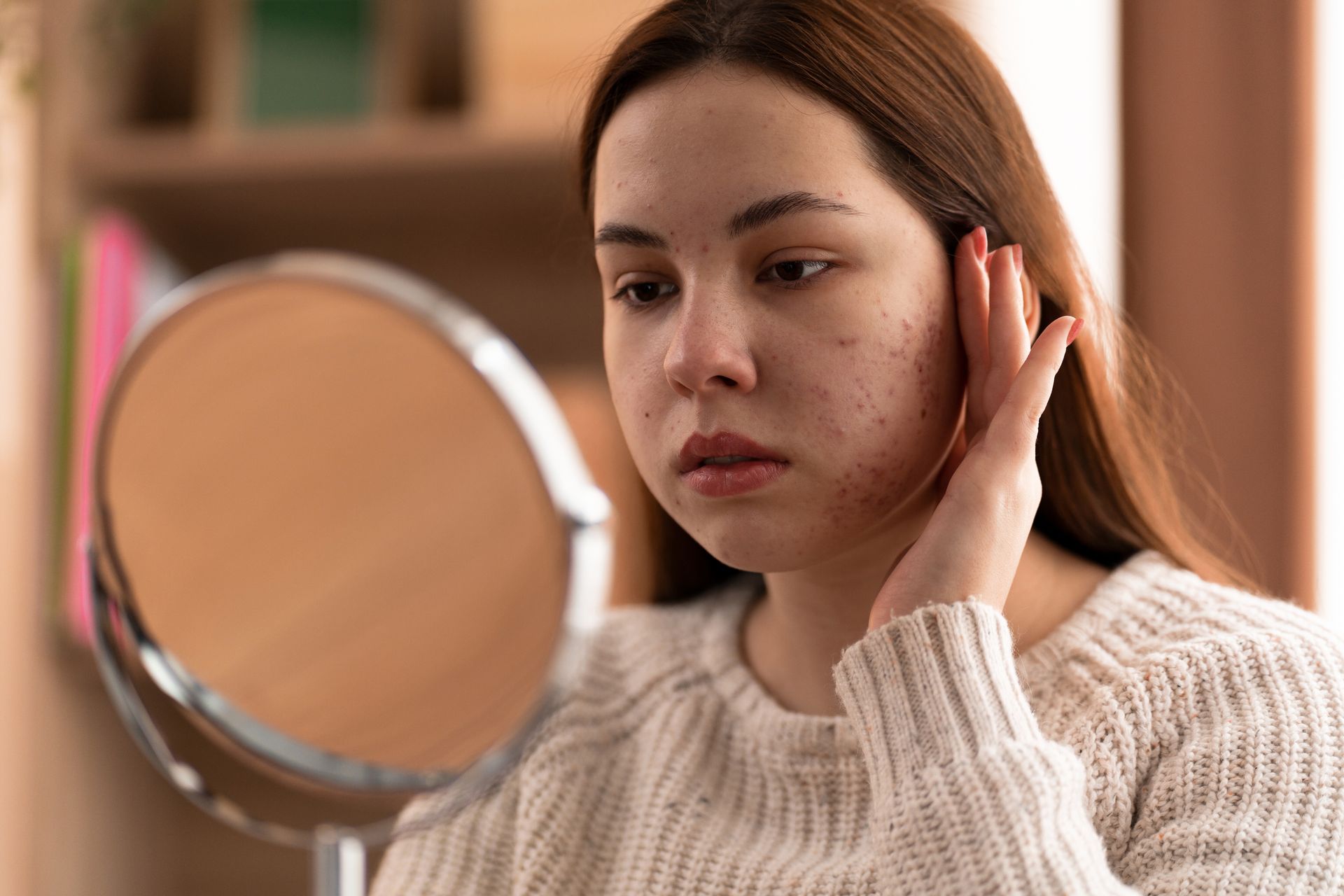 a woman with acne on her face looks at herself in a mirror