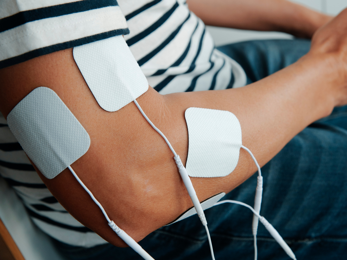 Adhesive electrode pads attached to a person's upper arm for TENS or electrical muscle stimulation therapy.