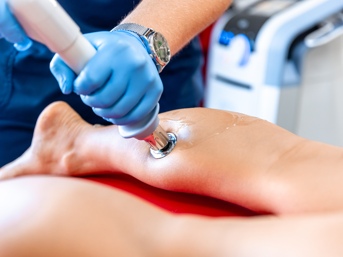 A gloved hand uses a laser therapy device on a patient's lower leg, which is coated in gel.